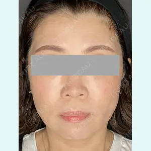Wi Clinic（ウィ クリニック） 銀座院の症例