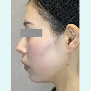 Wi Clinic（ウィ クリニック） 銀座院の症例