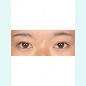 Wi Clinic（ウィ クリニック） 銀座院の症例