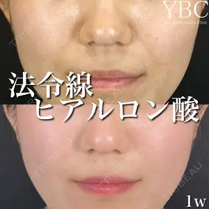 YBC横浜美容外科 大宮院の症例