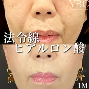 YBC横浜美容外科 大宮院 磯村 亮輔医師の症例
