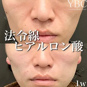 YBC横浜美容外科 大宮院 磯村 亮輔医師の症例