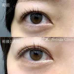 小倉美容外科ネビュラクリニックの症例