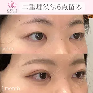 オーキッド美容クリニック東京御徒町 西浦 蘭子医師の症例