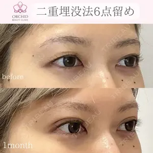 オーキッド美容クリニック東京御徒町 西浦 蘭子医師の症例