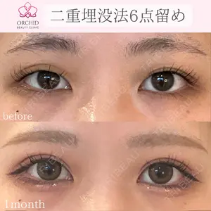 オーキッド美容クリニック東京御徒町 西浦 蘭子医師の症例