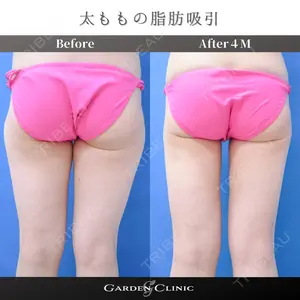 ガーデンクリニック 池袋院の症例