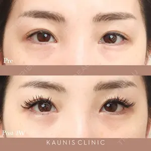 KAUNIS CLINIC（カウニスクリニック） 高野 敏郎医師の症例