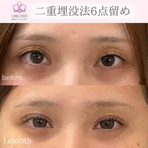 オーキッド美容クリニック東京御徒町 西浦 蘭子医師の症例