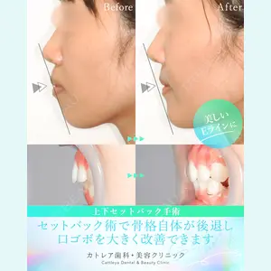 カトレア歯科・美容クリニック 辻 和志医師の症例