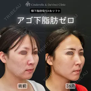 症例