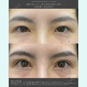 湘南美容クリニック 名古屋栄院の症例
