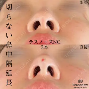 Brandnew Beauty Clinicの症例