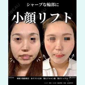 グローバルビューティークリニック 大阪院の症例