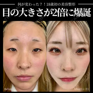 INO BEAUTY CLINIC 井上 紘基医師の症例
