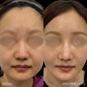 INO BEAUTY CLINIC 井上 紘基医師の症例