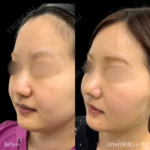 INO BEAUTY CLINIC 井上 紘基医師の症例