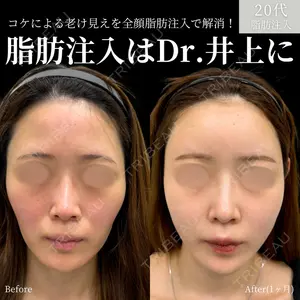 INO BEAUTY CLINICの症例