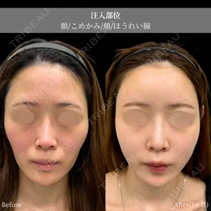 INO BEAUTY CLINICの症例