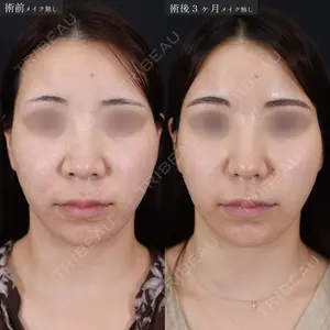 症例