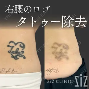 ziz CLINIC 村岡 史子医師の症例
