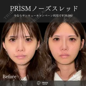 PRISM Beauty Clinic 畑山 知輝医師の症例