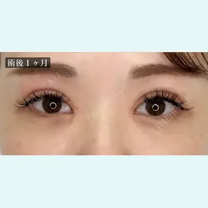 TCB東京中央美容外科 宇都宮院 岡本 卓也医師の症例