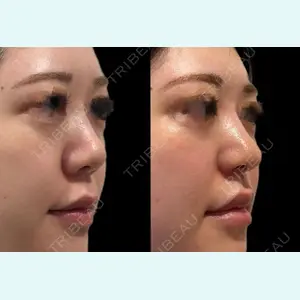 東京美専クリニック 土田 諒平医師の症例