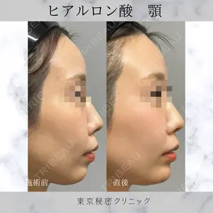 症例