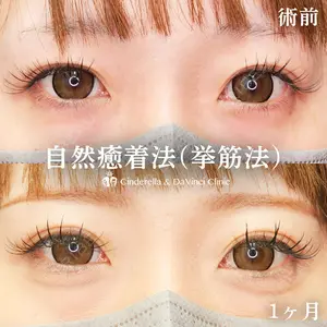 症例