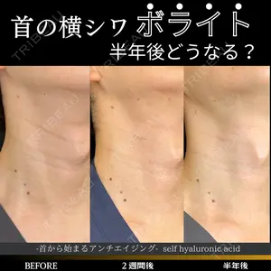 ルラ美容クリニック 大宮院 右京 大季医師の症例