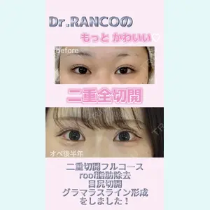 オーキッド美容クリニック東京御徒町 西浦 蘭子医師の症例