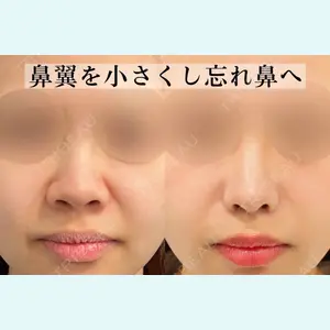 症例