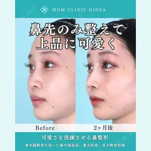 症例