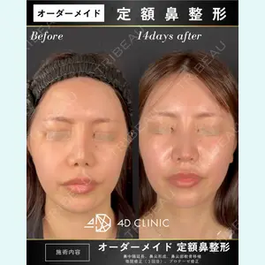 症例
