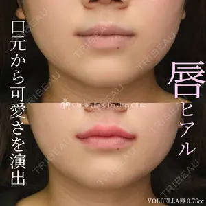 症例