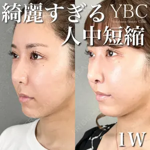 YBC横浜美容外科 大宮院の症例