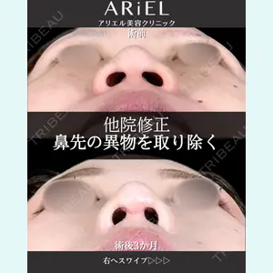 アリエル美容クリニック 大宮院 阪野 一世医師の症例