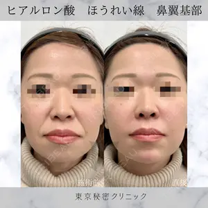 症例