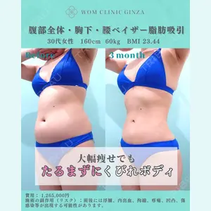 症例