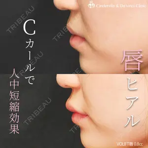 症例