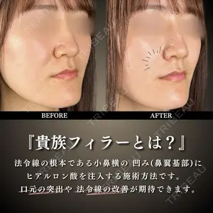 ルラ美容クリニック 千葉院 下川 洋輝医師の症例