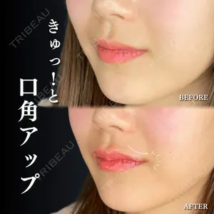 ルラ美容クリニック 千葉院 下川 洋輝医師の症例