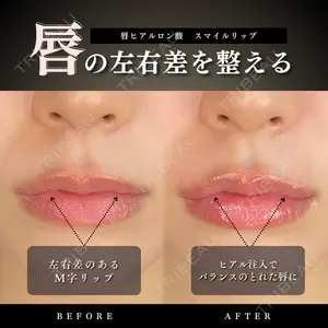 ルラ美容クリニック 千葉院 下川 洋輝医師の症例