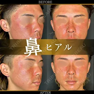 ルラ美容クリニック 大宮院 右京 大季医師の症例