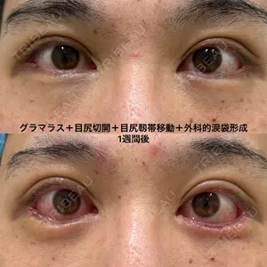 エターナル美容クリニック 久門田 詳医師の症例