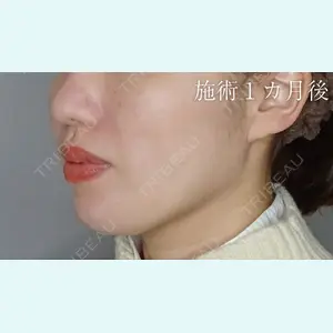 TCB東京中央美容外科 梅田大阪駅前院 寺西 宏王医師の症例
