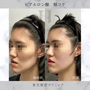 症例