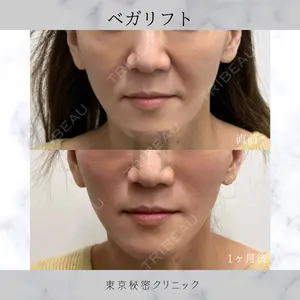 症例