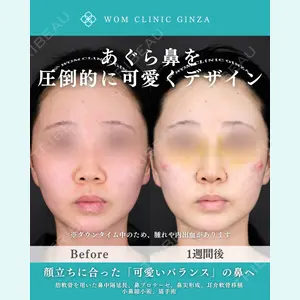 症例